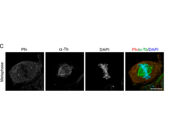 Confocal microscopy using Alpha Tubulin